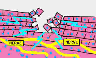 Nerve.jpg (21637 bytes)