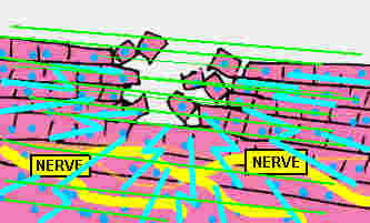 Nerve2.gif (19947 bytes)